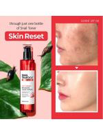 *พร้อมส่ง*Some By Mi Snail True Cica Miracle Repair Toner 135 ml. โทนเนอร์​ที่มีส่วนผสมของเมือกหอยทากสีดำ​ สมุนไพร​อีกเพียบและส่วนประกอบ TRUECICA เฉพาะตัวของ SOME BY MI มีส่วนช่วยคืนความแข็งแรงกลับสู่ธรรมชาติของผิว และยังสามา *พร้อมส่ง*Some By Mi Snail True Cica Miracle Repair Toner 135 ml. โทนเนอร์​ที่มีส่วนผสมของเมือกหอยทากสีดำ​ สมุนไพร​อีกเพียบและส่วนประกอบ TRUECICA เฉพาะตัวของ SOME BY MI มีส่วนช่วยคืนความแข็งแรงกลับสู่ธรรมชาติของผิว และยังสามา