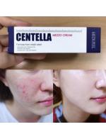 MEDI-PEELl Melanon X Centella Mezzo Cream Brightening Whitening Freckle 30ml. (Blue) ครีมที่ช่วยรักษารอยแผลเป็นรอยแดงจากสิวหลุมลึกจากสิวผื่นแพ้ต่างๆ ให้ดีขึ้น กระชับรูขุมขน ใช้สารสกัดจากธรรมชาติช่วยรักษาสิวได้ทุกชนิด ลดรอยสิว รอยดำ รอยแดง รอยแผล MEDI-PEELl Melanon X Centella Mezzo Cream Brightening Whitening Freckle 30ml. (Blue) ครีมที่ช่วยรักษารอยแผลเป็นรอยแดงจากสิวหลุมลึกจากสิวผื่นแพ้ต่างๆ ให้ดีขึ้น กระชับรูขุมขน ใช้สารสกัดจากธรรมชาติช่วยรักษาสิวได้ทุกชนิด ลดรอยสิว รอยดำ รอยแดง รอยแผล